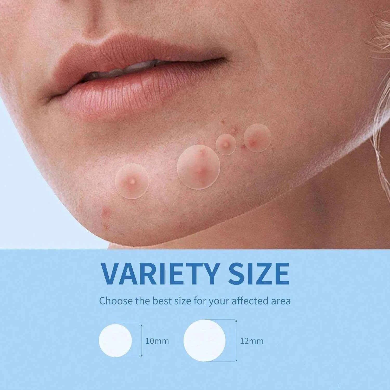 40/400 Pieces Hydrocolloid Acne Patches per Box Alcohol-Free Gentle Non-Irritating Blemish Covering Sticker for Pimples