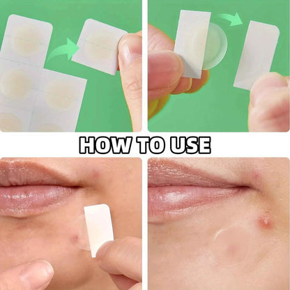 12/48 Tablets HITWORKER Hydrocolloid Acne Acne Patch Contains Tea Tree Oil and Hyaluronic Acid Invisible Acne Patch