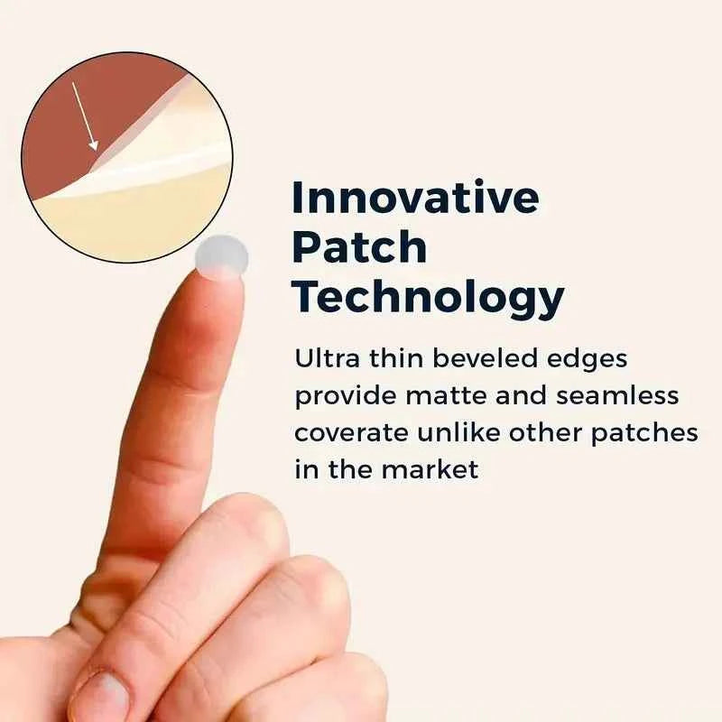 200/400/800pcs Invisible Clear Pimple Patch Set – Deep-Cleansing Hydrocolloid Acne Stickers, Mixed Sizes, Gentle & Skin-Friendly